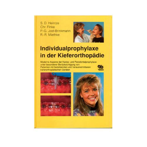 Individualprophylaxe in der Kieferorthopädie 